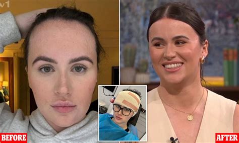 Bullied girl spends 27,000 pounds on surgery .